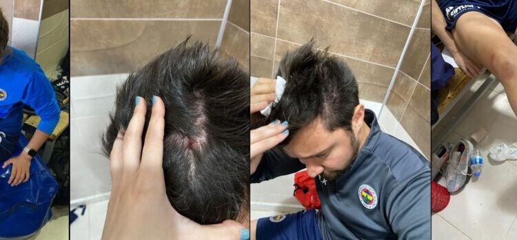 Fenerbahçeli kadın futbolcular kanlar içinde kalırken, Amed tribünlerinden taş ve sopalar atıldığı görüldü. Amed takımından bir oyuncu, yerde yatan Fenerbahçeli kadın futbolcunun başını tekmeledi. 1